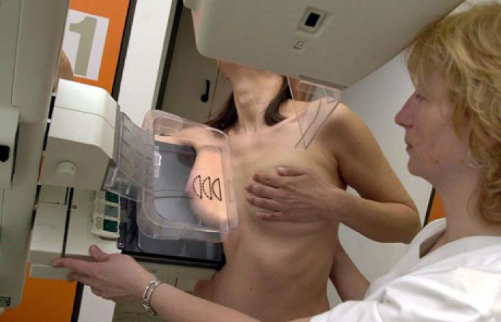 Service: Mammografie-Screening